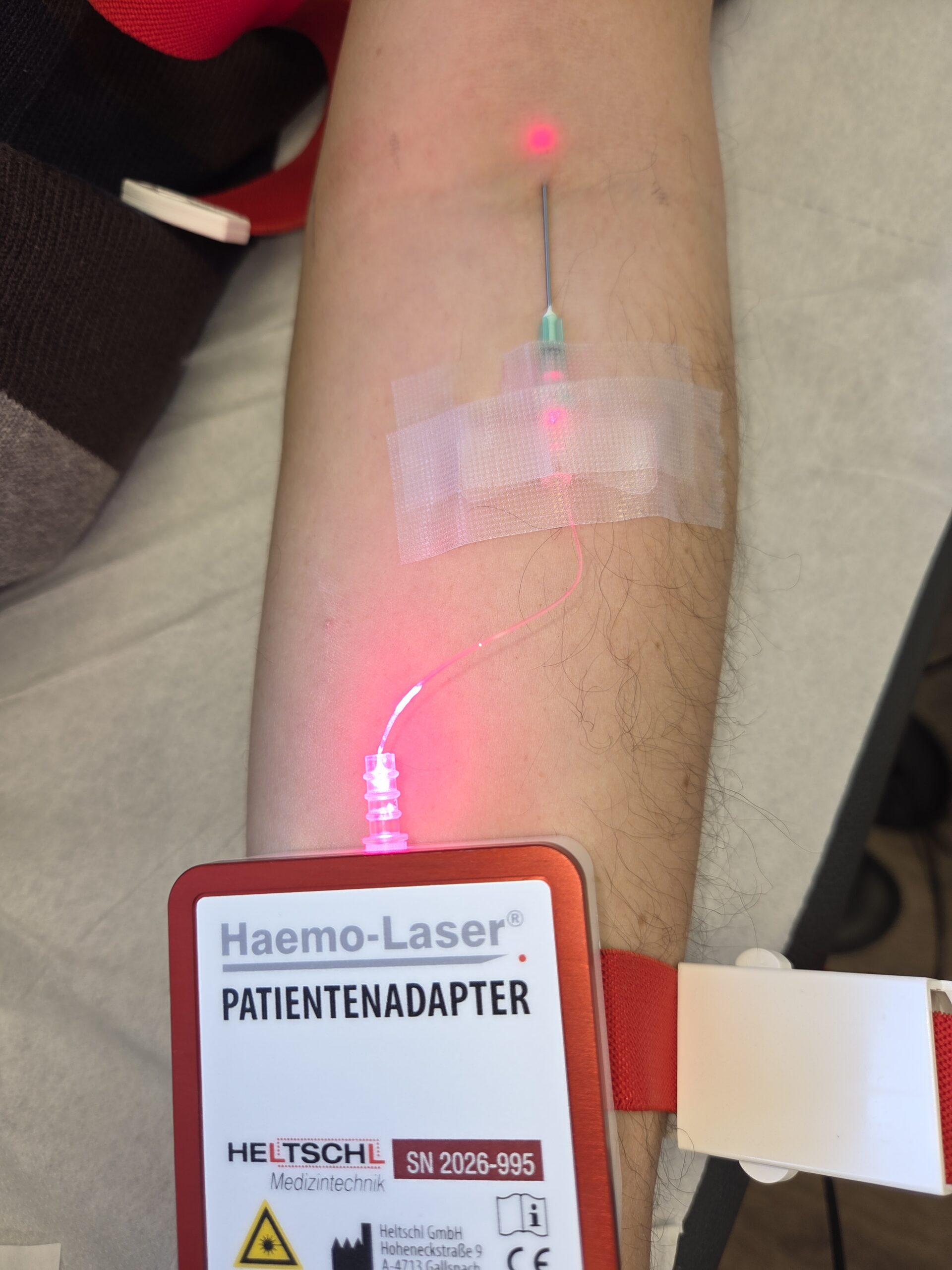 haemolaser